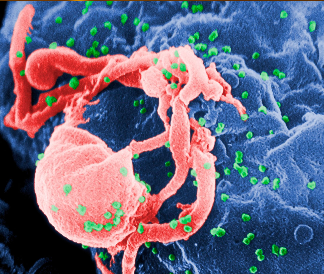 EVVIVAX Immunotherapy complements standard