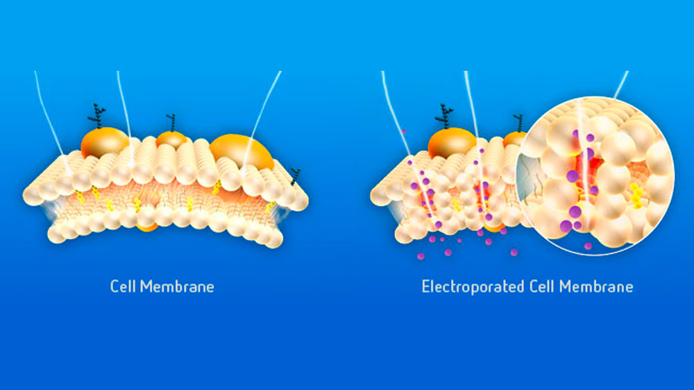 Tech In vivo electroporation